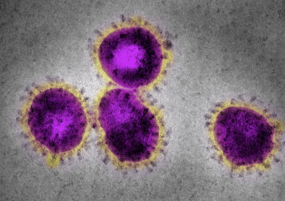 Coronaviruses with the characteristic spikes as seen under a microscope.