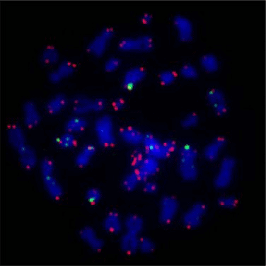 Telomere auf einem Mikroskop.