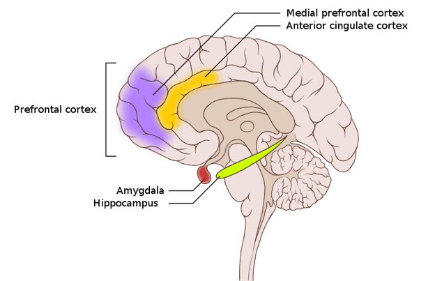 Neuroanatomie du cerveau d'une personne anxieuse