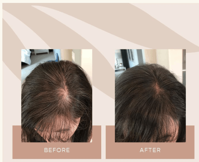 Vegamour before and after result