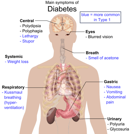 Symptoms of diabetes