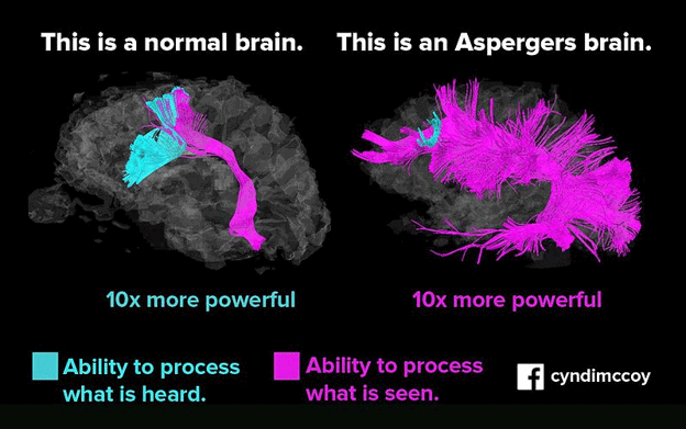 Brain activity comparing the brain of someone with Asperger syndrome and a brain of someone who is neurotypical