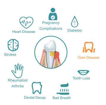 Algunas condiciones asociadas con la salud oral