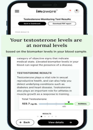 Imaware testosterone result at normal level