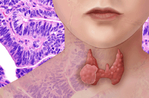 The thyroid is located at the base of the neck