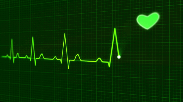 A sample of an EKG