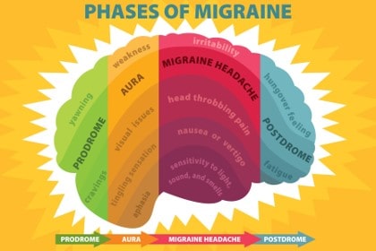 Phases of a migraine