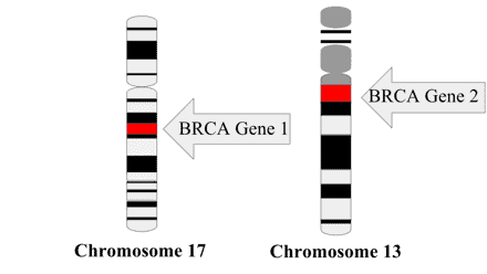 BRCA genes can be discovered during genetic cancer testing