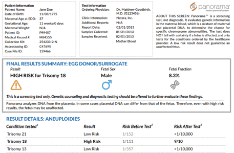 High risk for Trisomy 18 in a panorama report from Natera