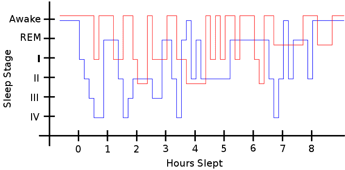 Changes in sleep patterns