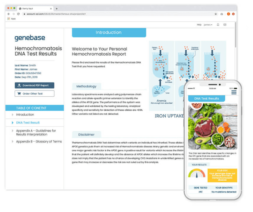 A sample report for hemochromatosis DNA Test