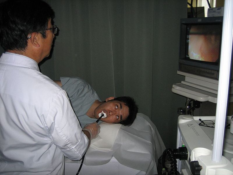 Upper endoscopy procedure