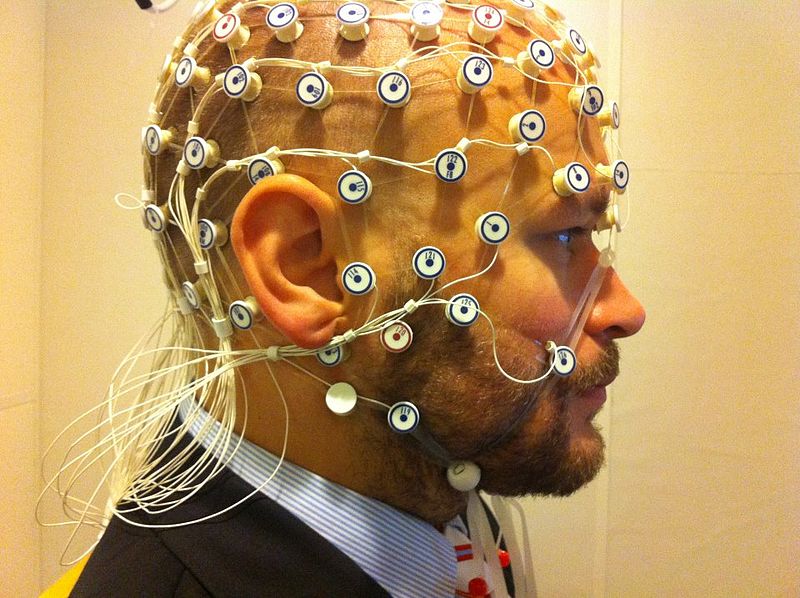 An EEG recording