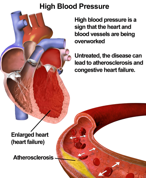 What it looks like in the heart and vessels