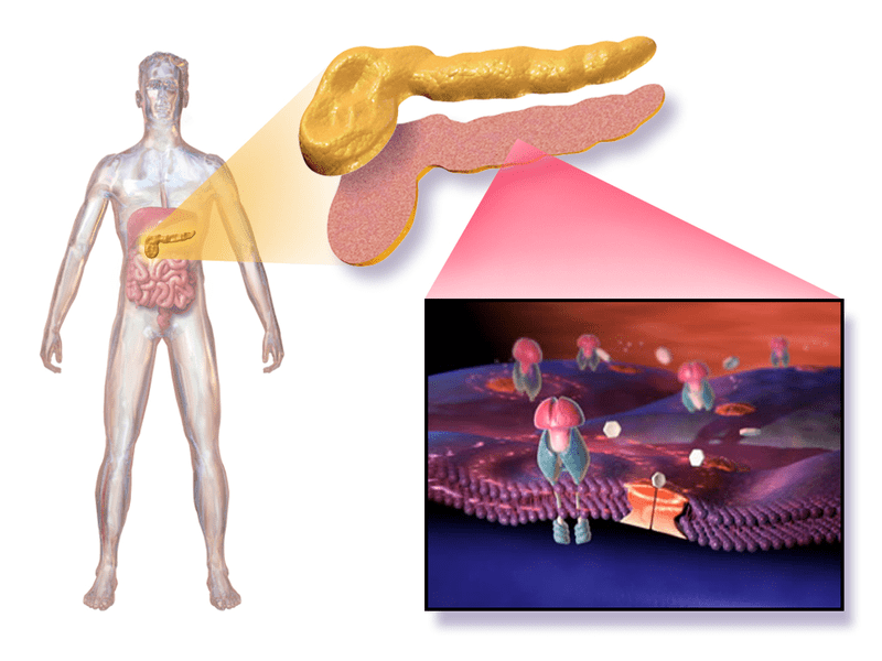 Type 2 diabetes occurs when the pancreas no longer makes enough insulin to control blood sugar levels