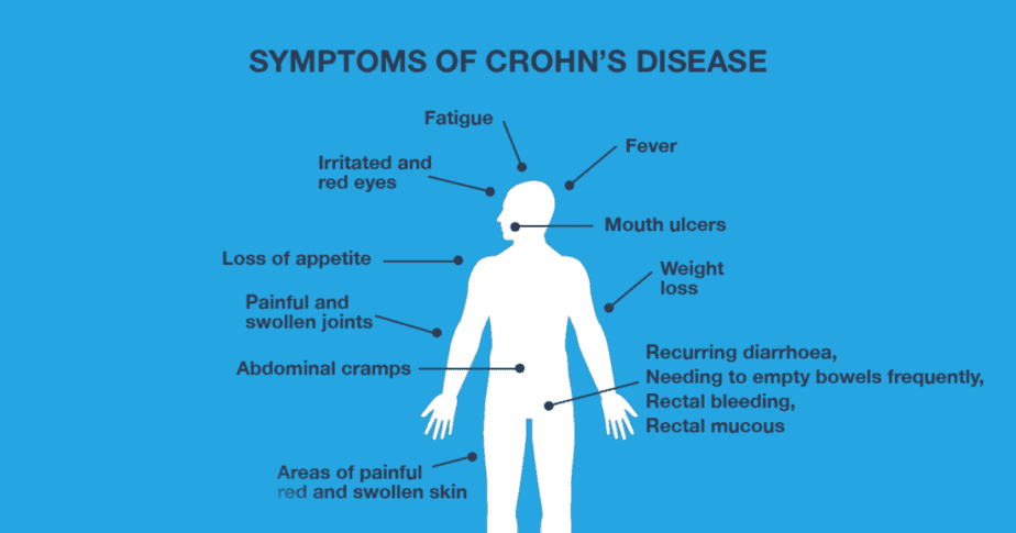 Is Crohn's Disease Genetic?  Decode your DNA to learn your risks!