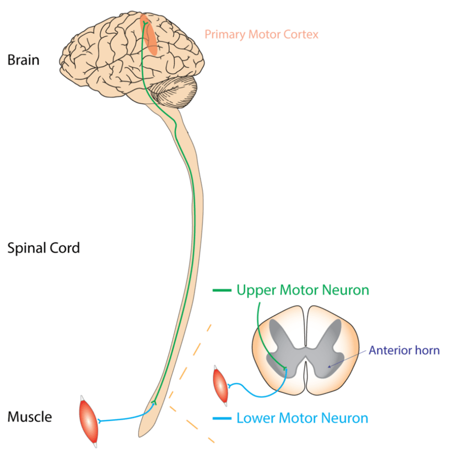 Upper and lower neurons as they relate to ALS