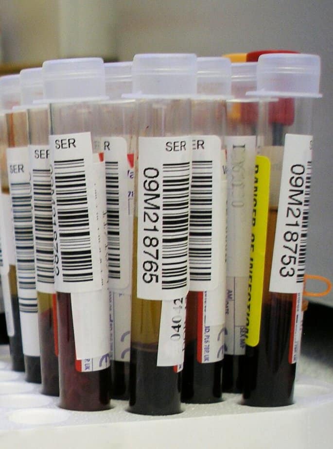 Blood tests