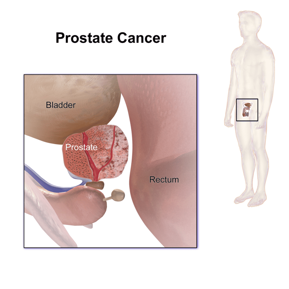 Location of the prostate