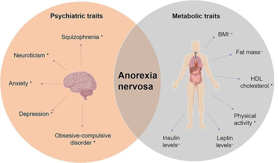 A Venn diagram showing the common psychiatric and metabolic conditions common in anorexia and other eating disorders