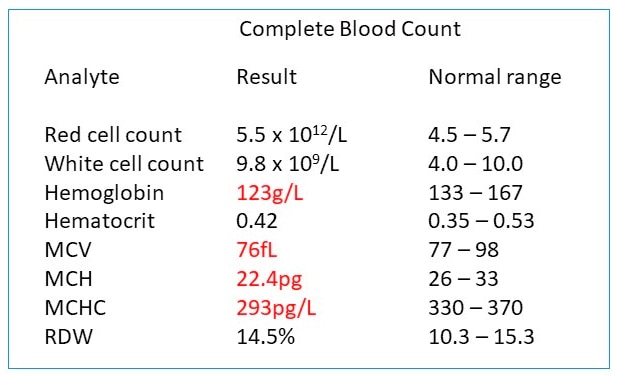 Example of a complete blood cell count