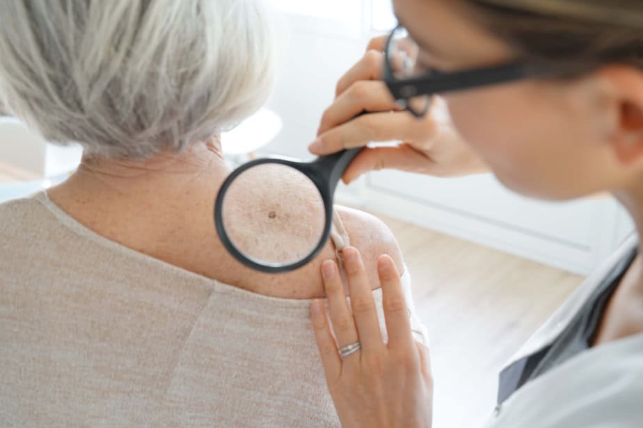 A doctor looking at skin cancer