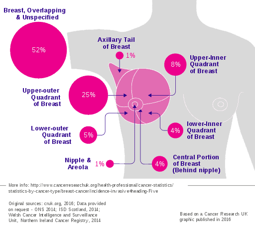 Breast cancer sites