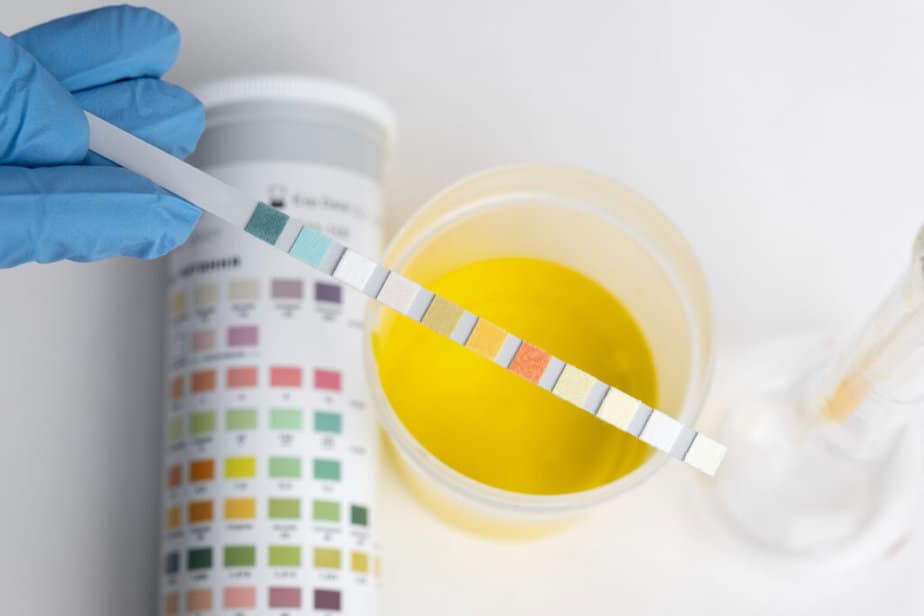 Urine test