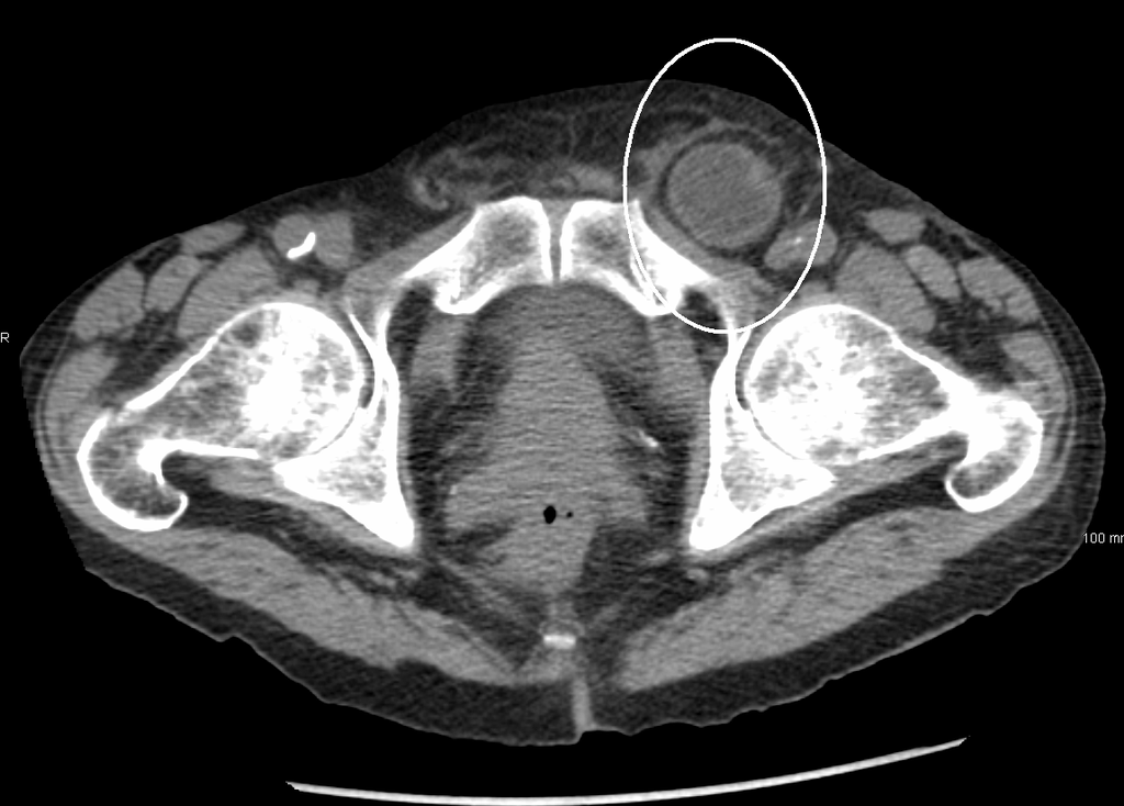 Diagnosis on a CT scan