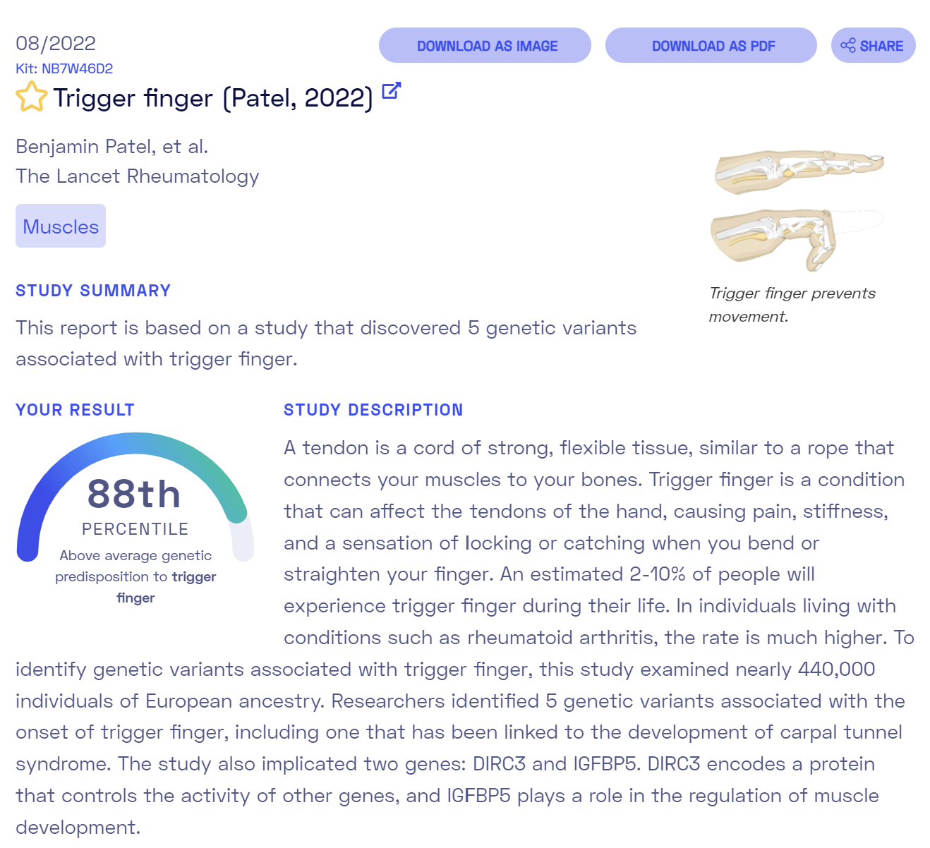 Is trigger finger Decode your DNA and learn your risks!